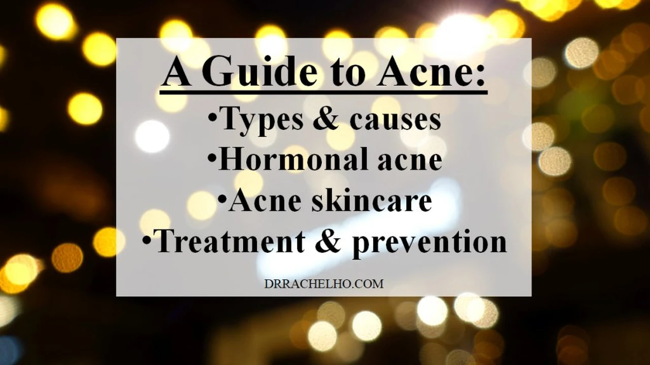 Two mint chocolate milkshakes with whipped cream and green sprinkles.